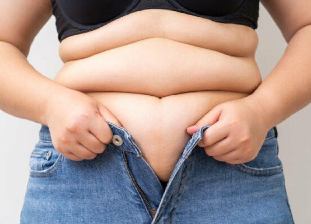 ¿Qué causa el sobrepeso y la obesidad?